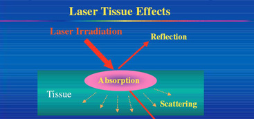 Lasers in nonsurgical periodontal therapy