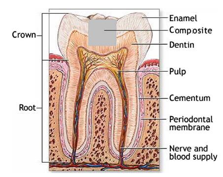 dental laser tips