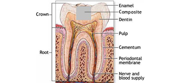 Precise dental ablation using ultra-short-pulsed 1552 nm laser