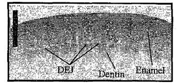 Imaging  and  characterization  of  dental  structure using optical coherence  tomography 