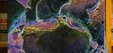  Selection of an appropriate laser wavelength for launching surface acoustic waves on tooth enamel