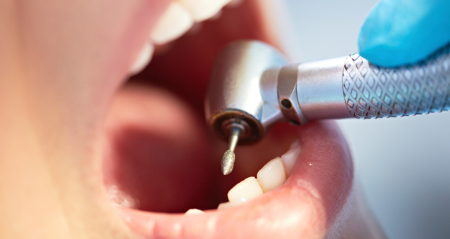 dental laser tips