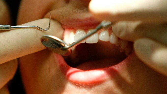 dental laser tips