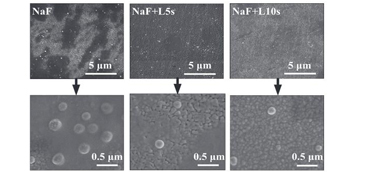 Topical Laser Application Enhances Enamel Fluoride uptake and tribological properties