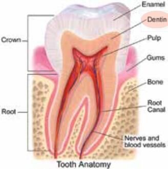 dental laser tips