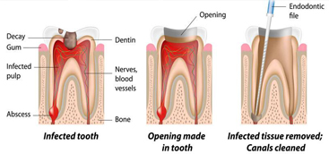 Groundbreaking advances in dental treatment  could regenerate teeth rather than replace them.