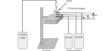 Temperature variation at the external root surface during 980-nm diode laser irradiation in the root canal