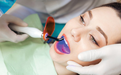 dental laser accessories