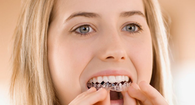 tooth whitening dental laser